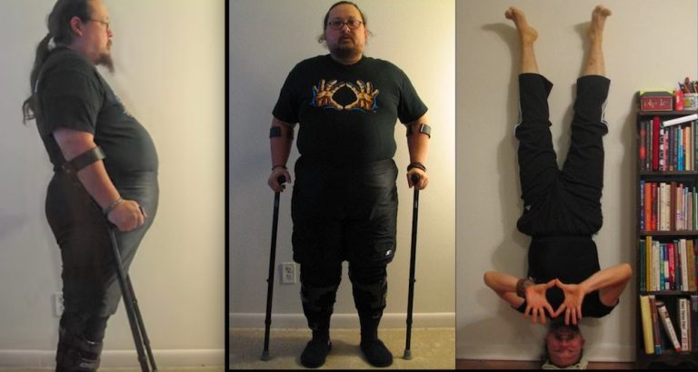Disabled Veteran Proves Doctors Who Told Him He’d Never Walk Unassisted Again Wrong