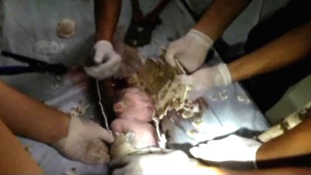 baby freed from sewer pipe