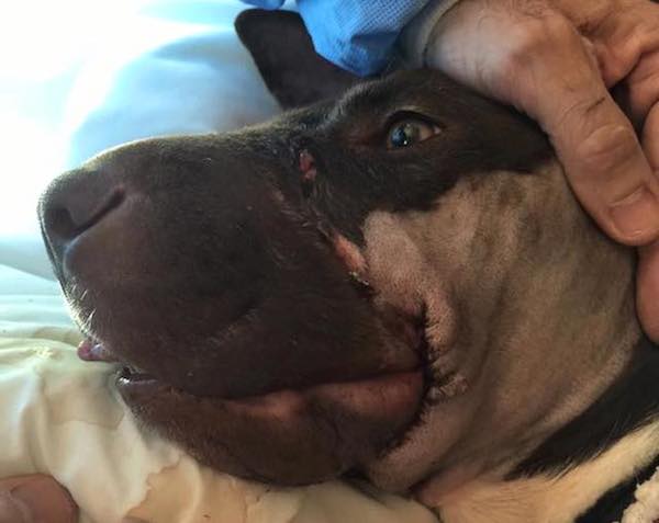 caitlyn-surgery