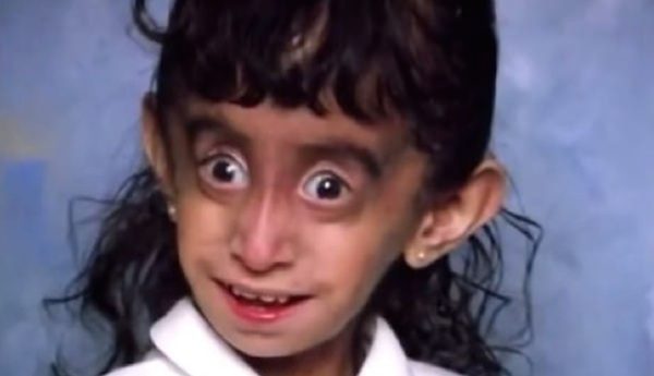 Lizzie Velásquez Motivated To Change Her Life After Bullies Called Her The ‘World’s Ugliest Woman’