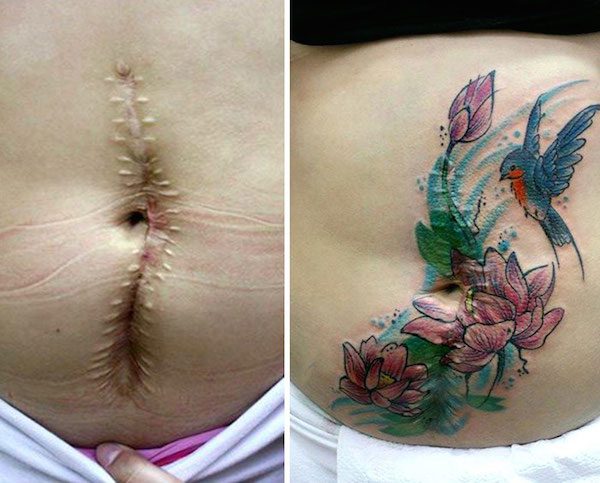 scars-tattoo-2