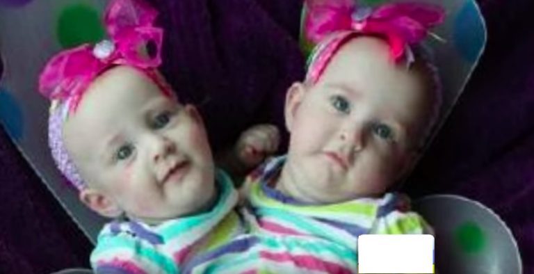 Conjoined Twins Who Are Successfully Separated Called ‘An Absolute Miracle’