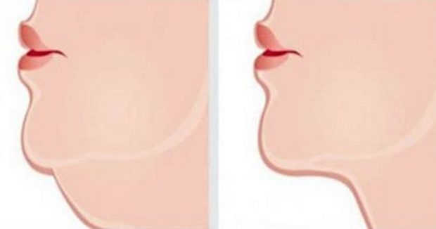 Simple Stretching Exercises Help To Get Rid Of That Unsightly Double Chin