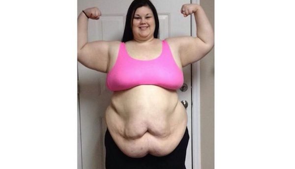 Young Woman Who Weighed 414 Pounds Loses Over Half Her Bodyweight In 15 Months