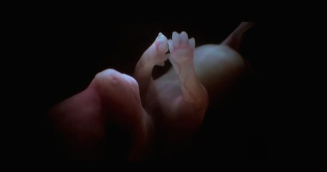 dog in womb