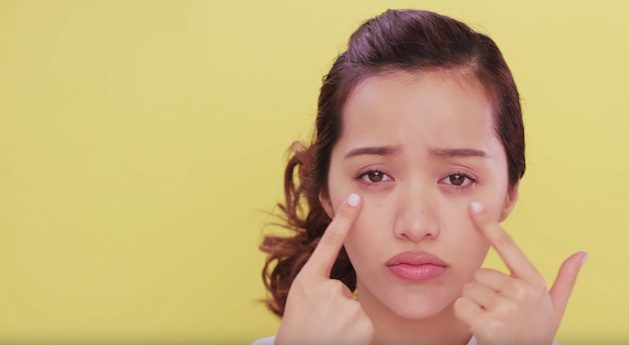 black circles under eyes