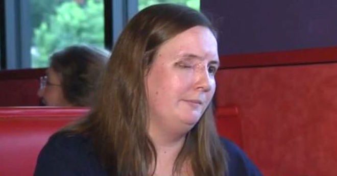 Woman Who Lost Eye After Violent Carjacking Adopts Puppy Who Lost An Eye Too