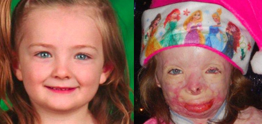 Little Girl Who Survived Fire That Killed Her Entire Family Asks For Christmas Cards For Christmas