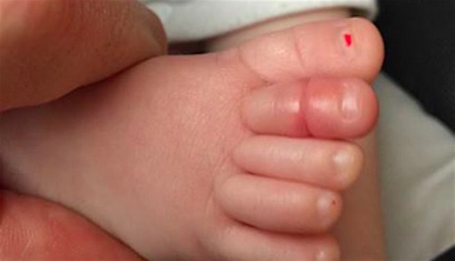 Father Warns Parents Of The Dangers That A Hair In A Sock Can Pose To Babies