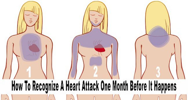 How To Recognize The Symptoms Of A Heart Attack