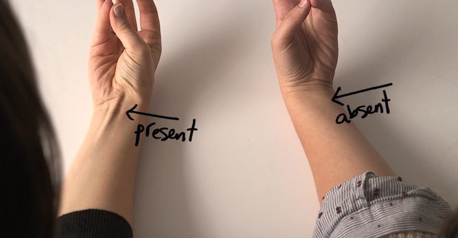 Proof Of Evolution That You Can Find On Your Body