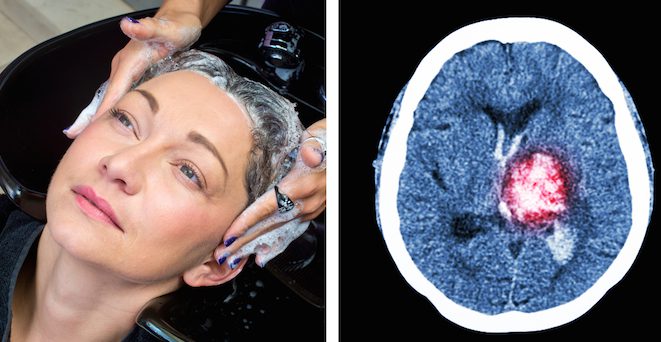 Woman Shocked When She Learns Why She Suffered Stroke After Getting Hair Shampooed At Salon
