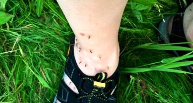 Why Mosquitoes Prefer To Bite Some People and Leave Others Alone