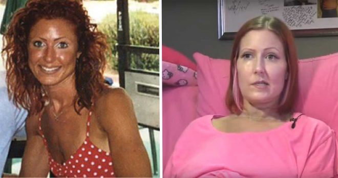 Skin Cancer Victim’s Dying Wish Was To Warn Everyone Of The Dangers Of Tanning Beds