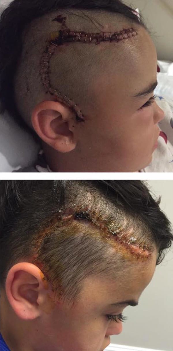 bike-helmet-warning-3