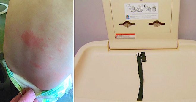 Mom Finds Something Horrible Stuck In Changing Mat In Public Restroom