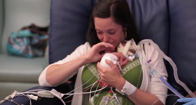 premature baby