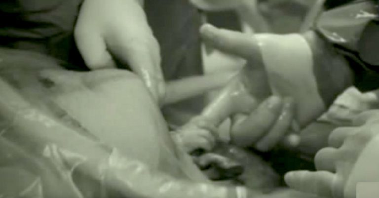 Baby Grabs Hold Of Doctor’s Finger While Still In Mother’s Womb
