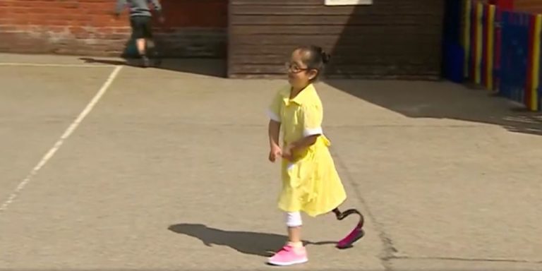 Classmates’ Reaction To Schoolgirl’s New Prosthetic Blade Is Melting Hearts