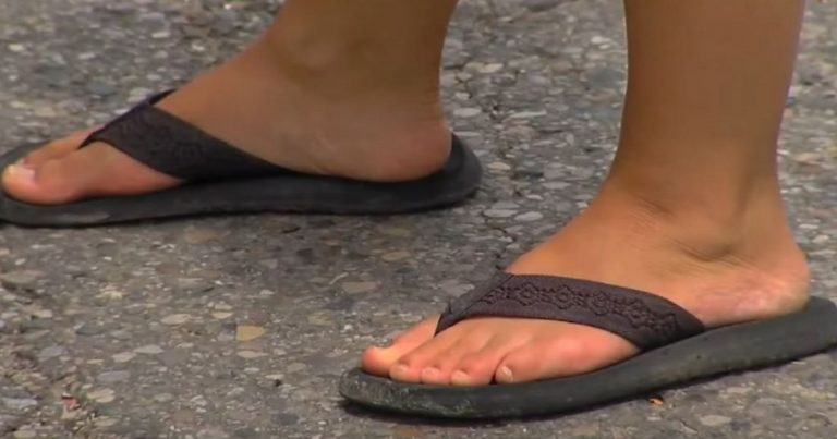 Doctors Warn About The Dangers Of Wearing Flip Flops